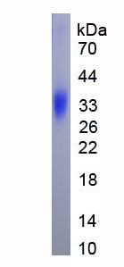 Eukaryotic Tissue Plasminogen Activator (tPA)