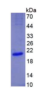 Eukaryotic Endostatin (ES)