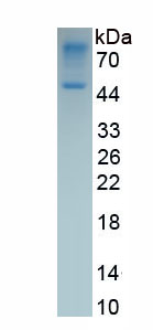 Eukaryotic Fibroblast Growth Factor 2, Basic (FGF2)