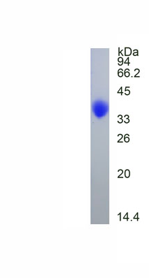 Eukaryotic Tissue Inhibitors Of Metalloproteinase 1 (TIMP1)