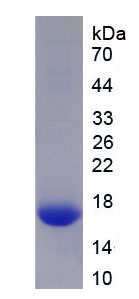 Eukaryotic Fatty Acid Binding Protein 2, Intestinal (FABP2)