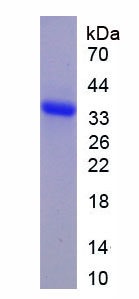 Eukaryotic Epidermal Growth Factor (EGF)