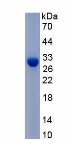 Eukaryotic Procollagen III N-Terminal Propeptide (PIIINP)