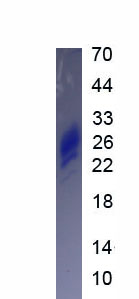 Eukaryotic Interleukin 7 (IL7)