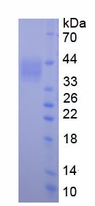 Eukaryotic Dickkopf Related Protein 1 (DKK1)