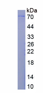 Eukaryotic Programmed Cell Death Protein 1 (PD1)