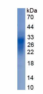 Eukaryotic Programmed Cell Death Protein 1 (PD1)