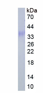 Eukaryotic Chemokine C-X-C-Motif Ligand 16 (CXCL16)