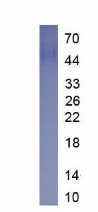 Eukaryotic Kidney Injury Molecule 1 (Kim1)