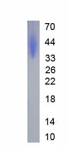 Eukaryotic Programmed Cell Death Protein 1 Ligand 2 (PDL2)