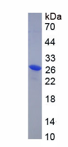 Eukaryotic C Reactive Protein (CRP)