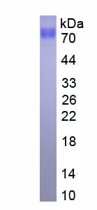 Eukaryotic Plasmin/Antiplasmin Complex (PAP)