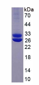 Eukaryotic Prolactin (PRL)