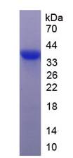 Eukaryotic Resistin (RETN)