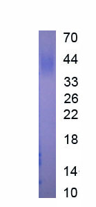 Eukaryotic Cluster Of Differentiation 200 (CD200)