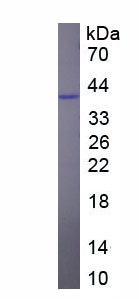 Eukaryotic Pulmonary Surfactant Associated Protein A1 (SFTPA1)