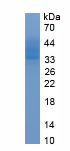 Eukaryotic Chemokine C-C-Motif Receptor 3 (CCR3)