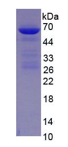 Eukaryotic Albumin (ALB)