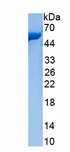 Eukaryotic S100 Calcium Binding Protein A12 (S100A12)