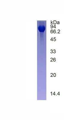 Eukaryotic Transferrin Receptor (TFR)