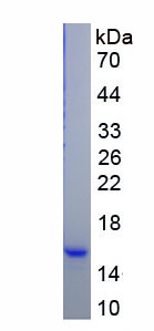 Eukaryotic Pro-Gastrin Releasing Peptide (ProGRP)