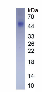 Eukaryotic Cluster Of Differentiation 56 (CD56)