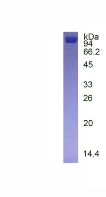 Eukaryotic Cluster Of Differentiation 56 (CD56)