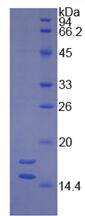 Eukaryotic Integrin Beta 3 (ITGb3)