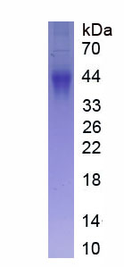 Eukaryotic Fc Fragment Of IgG Low Affinity IIIb Receptor (FcgR3B)