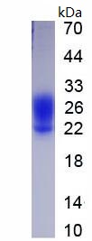 Eukaryotic Fc Fragment Of IgG Low Affinity IIIa Receptor (FcgR3A)