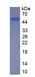 Eukaryotic Cathepsin D (CTSD)