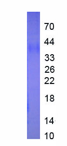 Eukaryotic Immunoglobulin Associated Alpha (Iga)