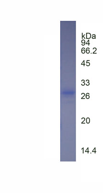 Eukaryotic Neutrophil gelatinase-associated lipocalin (NGAL)