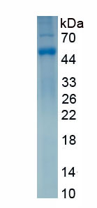 Eukaryotic Interleukin 5 Receptor Alpha (IL5Ra)