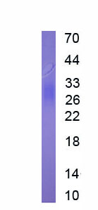 Eukaryotic Cluster Of Differentiation 147 (CD147)