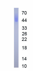 Eukaryotic Cluster Of Differentiation 147 (CD147)