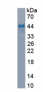 Eukaryotic Interleukin 10 Receptor Beta (IL10Rb)