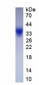 Eukaryotic Cluster Of Differentiation 7 (CD7)