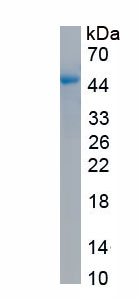 Eukaryotic Interleukin 7 Receptor (IL7R)