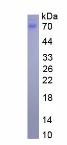 Eukaryotic Glial Cell Line Derived Neurotrophic Factor Receptor Alpha 2 (GFRa2)