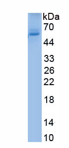 Eukaryotic Protein Tyrosine Phosphatase, Non Receptor Type 1 (PTPN1)