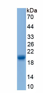 Eukaryotic Allograft inflammatory factor 1 (AIF1)