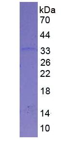 Eukaryotic Fibrinogen Gamma (FGg)