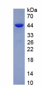 Eukaryotic Ferroportin (FPN)