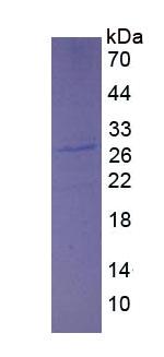 Eukaryotic Growth Factor Receptor Bound Protein 2 (Grb2)