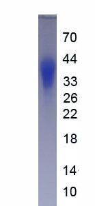 Eukaryotic Kisspeptin 1 (KISS1)