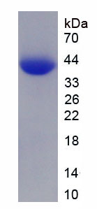 Eukaryotic Villin (VIL)