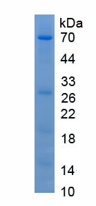 Eukaryotic Insulin Like Growth Factor Binding Protein 5 (IGFBP5)