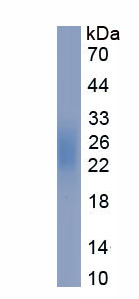 Eukaryotic Glutathione Peroxidase 3, Plasma (GPX3)