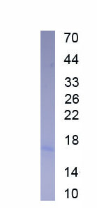 Eukaryotic T-Cell Surface Glycoprotein CD3 Epsilon (CD3e)